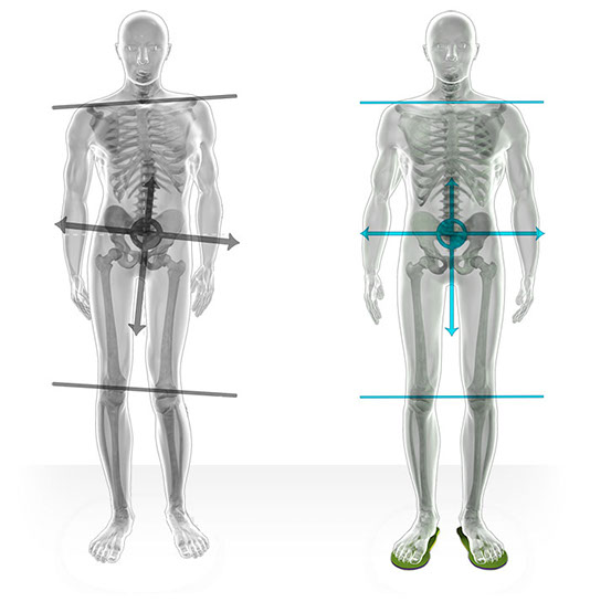 diferencia postural